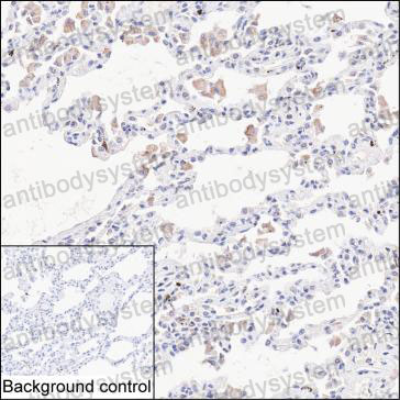 Anti-CCL26/Eotaxin-3/TSC-1 Antibody (R3X62)