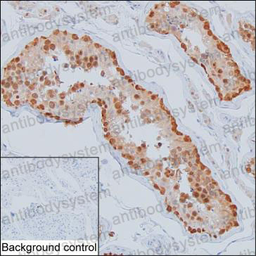 Anti-PLAA Antibody (R3X63)