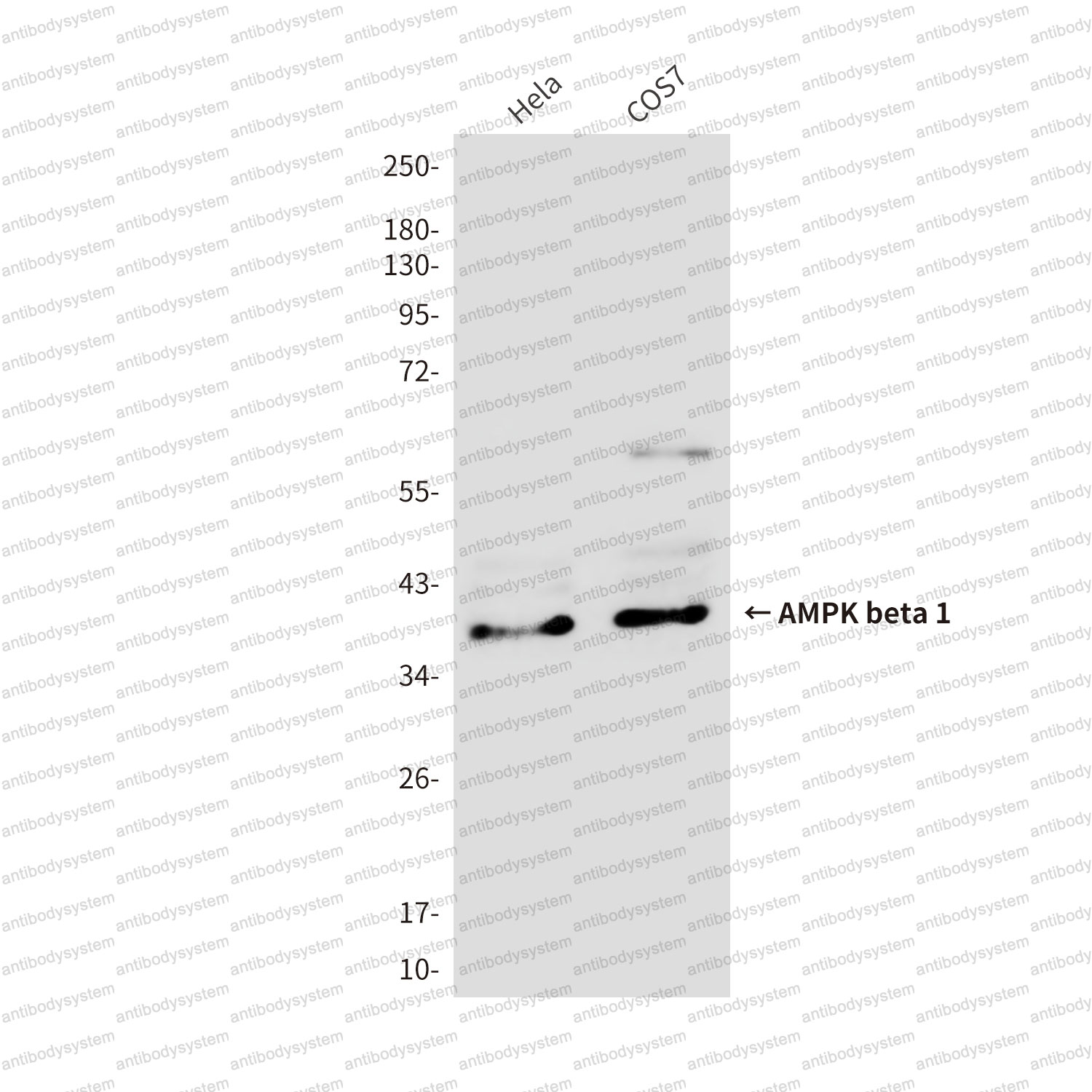 Anti-PRKAB1 Antibody (R3X67)