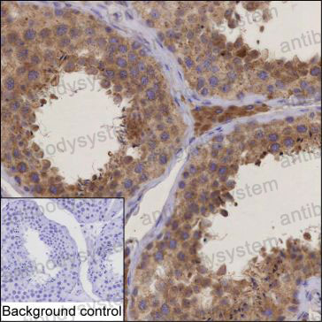 Anti-MAP4K5 Antibody (R3X68)
