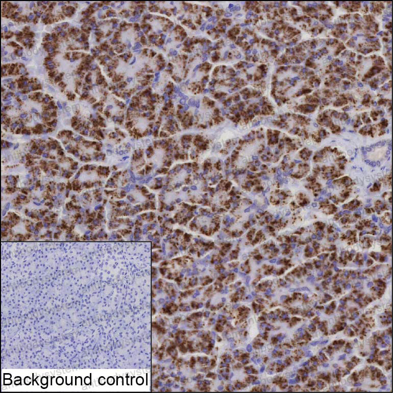 Anti-RIPK3 Antibody (R3X70)