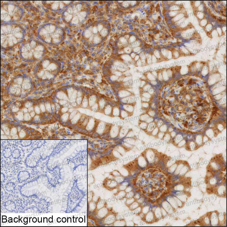 Anti-CD2AP Antibody (R3X71)