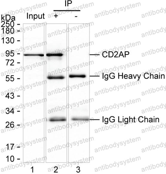 Anti-CD2AP Antibody (R3X72)