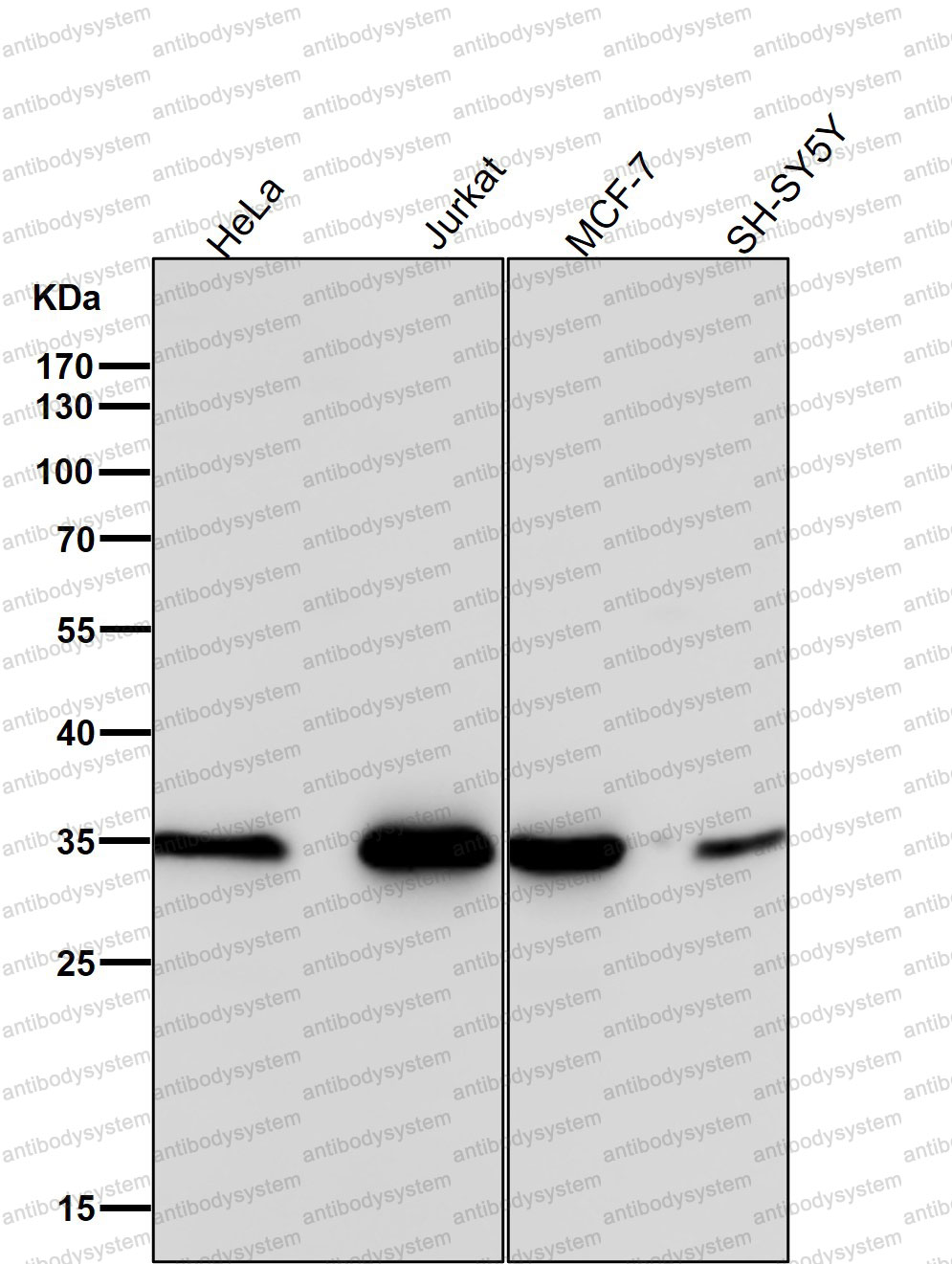 Western blot for Anti-LYVE1 Antibody (R2L23) ?>