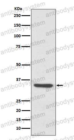 Western blot for Anti-LYVE1 Antibody (R2L23) ?>