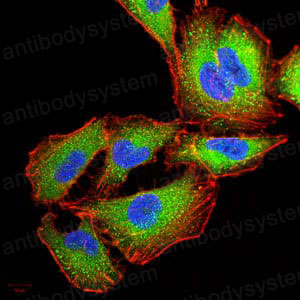 Anti-IRAK3 Antibody (R3X75)