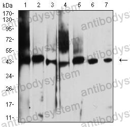 Anti-AUP1 Antibody (R3X79)