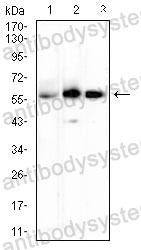Anti-CD265/TNFRSF11A Antibody (R3X86)