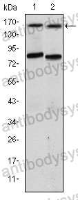 Anti-NCOA3/AIB1 Antibody (R3X87)