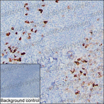 Anti-Human IgA2 Antibody (R3X90)