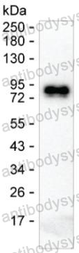 Anti-Human IgE Antibody (R3X91)