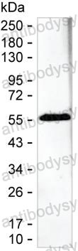 Anti-Human IgG1 Antibody (R3X93)