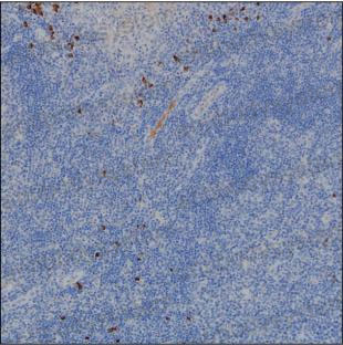 Anti-Human IgG2 Antibody (R3X96)
