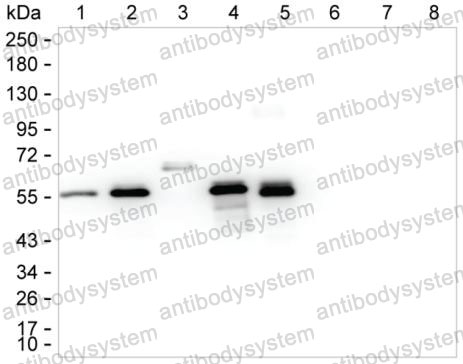 Anti-Human IgG2 Antibody (R3X95)