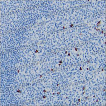 Anti-Human IgG3 Antibody (R3X97)