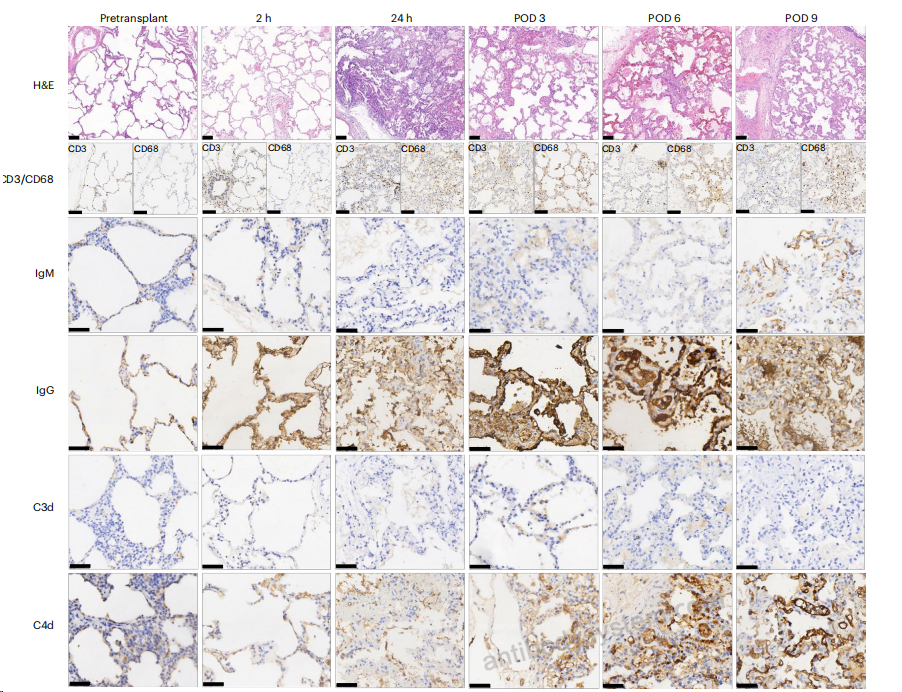 Immunohistochemistry for Anti-Human IgM Antibody (SAA0809) ?>