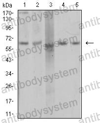 Anti-AP2M1 Antibody (R3Y20)
