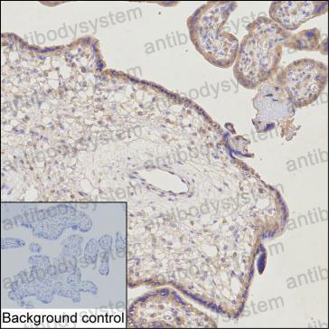 Anti-C1QTNF1 Antibody (R3Y23)