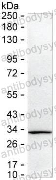 Anti-C1QTNF1 Antibody (R3Y24)