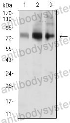 Anti-ACSS1 Antibody (R3Y26)