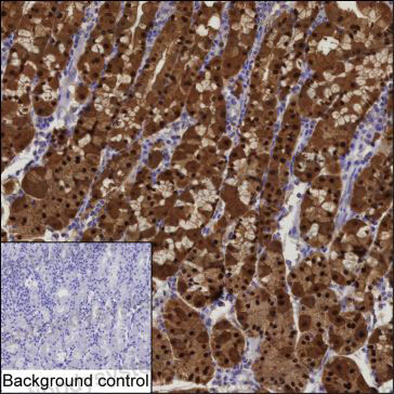 Anti-ANXA10 Antibody (R3Y28)