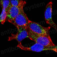 Anti-AMACR Antibody (R3Y29)