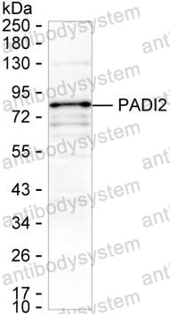 Anti-PADI2 Antibody (R3Y45)