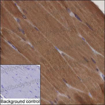 Anti-PADI2 Antibody (R3Y44)