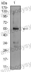 Anti-ASF1B Antibody (R3Y59)