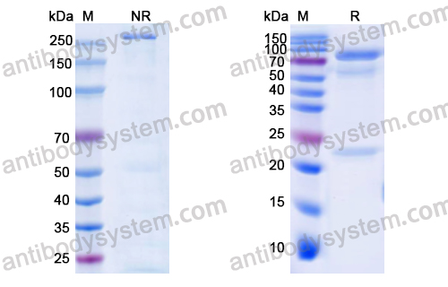 Human Rheumatoid Factor IgM Antibody (RF61)