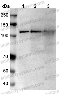 Anti-Human TRPM4/LTRPC4 Antibody (SAA0760)