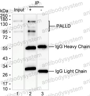 Anti-PALLD Antibody (R3Y75)
