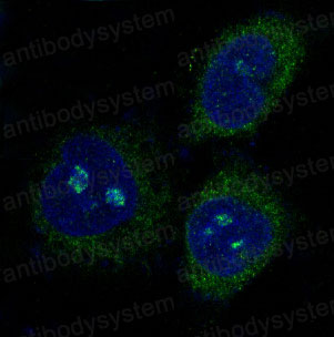 Anti-BBC3/PUMA Antibody (R1B94)