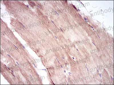 Anti-TRIM63 Antibody (R3Y78)