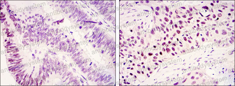 Anti-KDM3A Antibody (R3Y80)