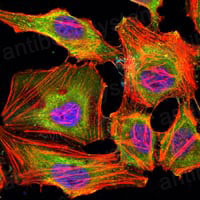 Anti-KDM3A Antibody (R3Y81)