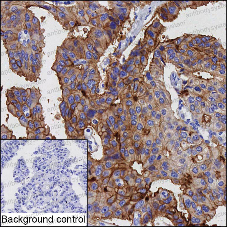 Anti-STEAP4 Antibody (R3Y86)