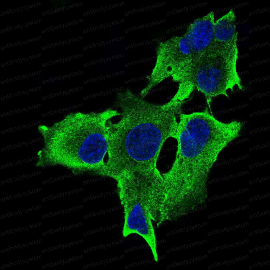 Anti-RPTOR Antibody (R3Y87)