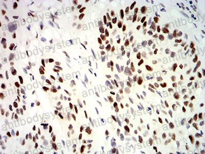 Anti-UHRF1 Antibody (R3Y93)