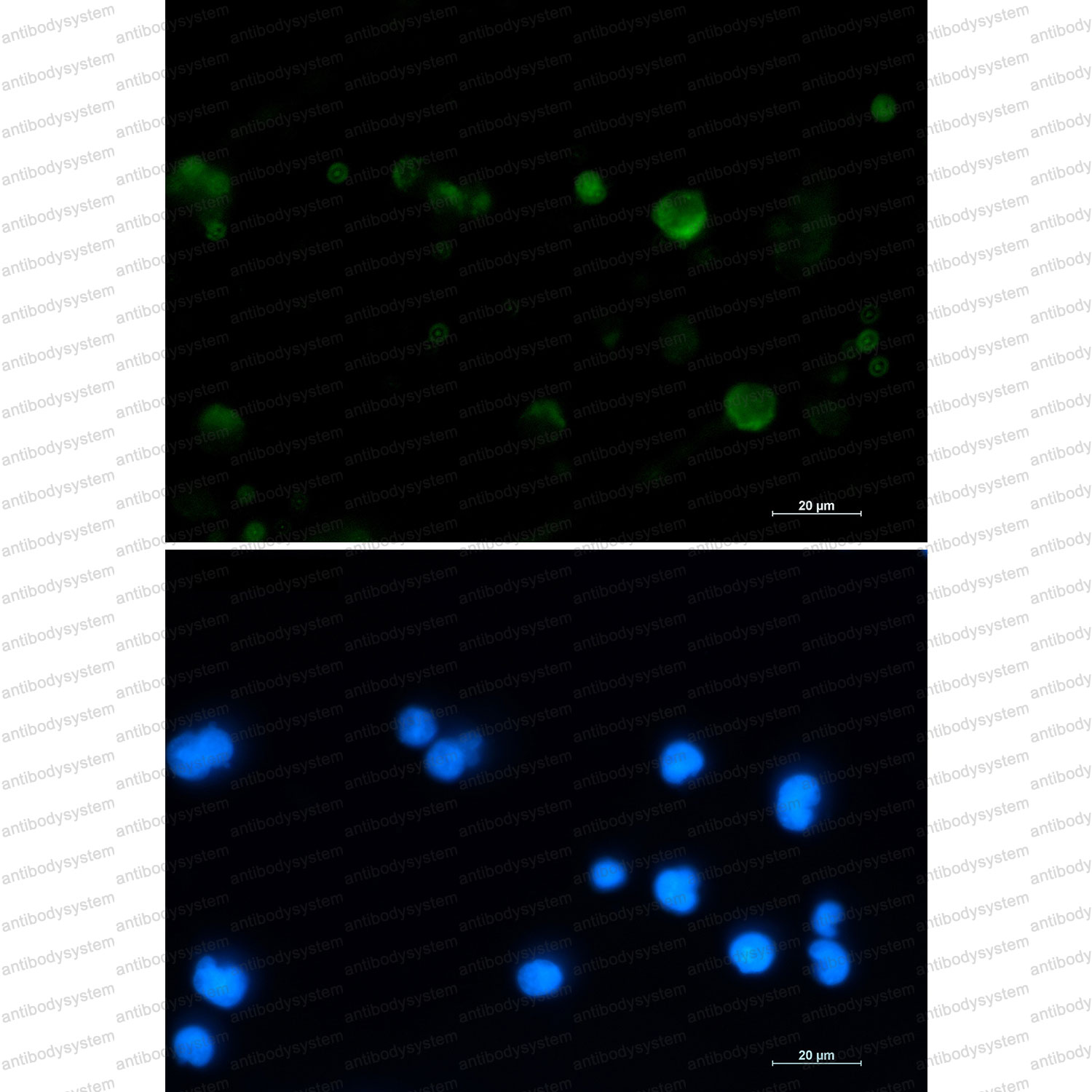 Immunofluorescence for Anti-ACO2 Antibody (R2M08) ?>