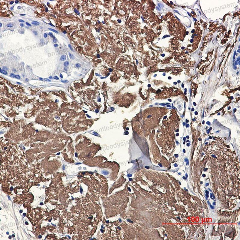 Immunohistochemical for Anti-ACO2 Antibody (R2M08) ?>