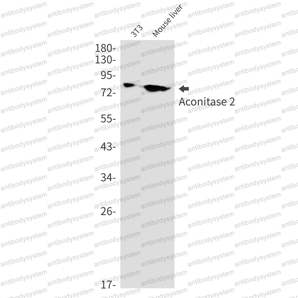 Western blot for Anti-ACO2 Antibody (R2M08) ?>