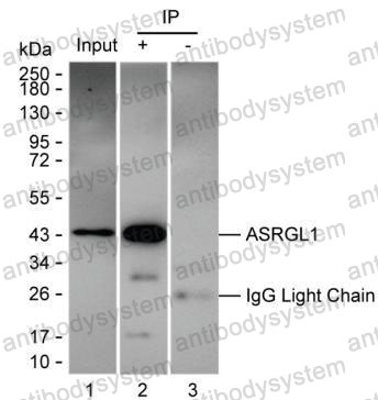 Anti-ASRGL1 Antibody (R3Y95)