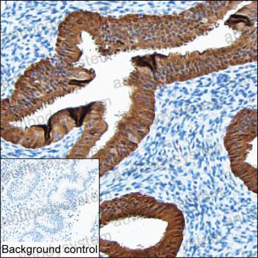 Anti-ASRGL1 Antibody (R3Y96)