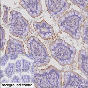 Anti-TRIM31 Antibody (R3Y97)