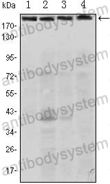 Anti-RICTOR Antibody (R3Z04)