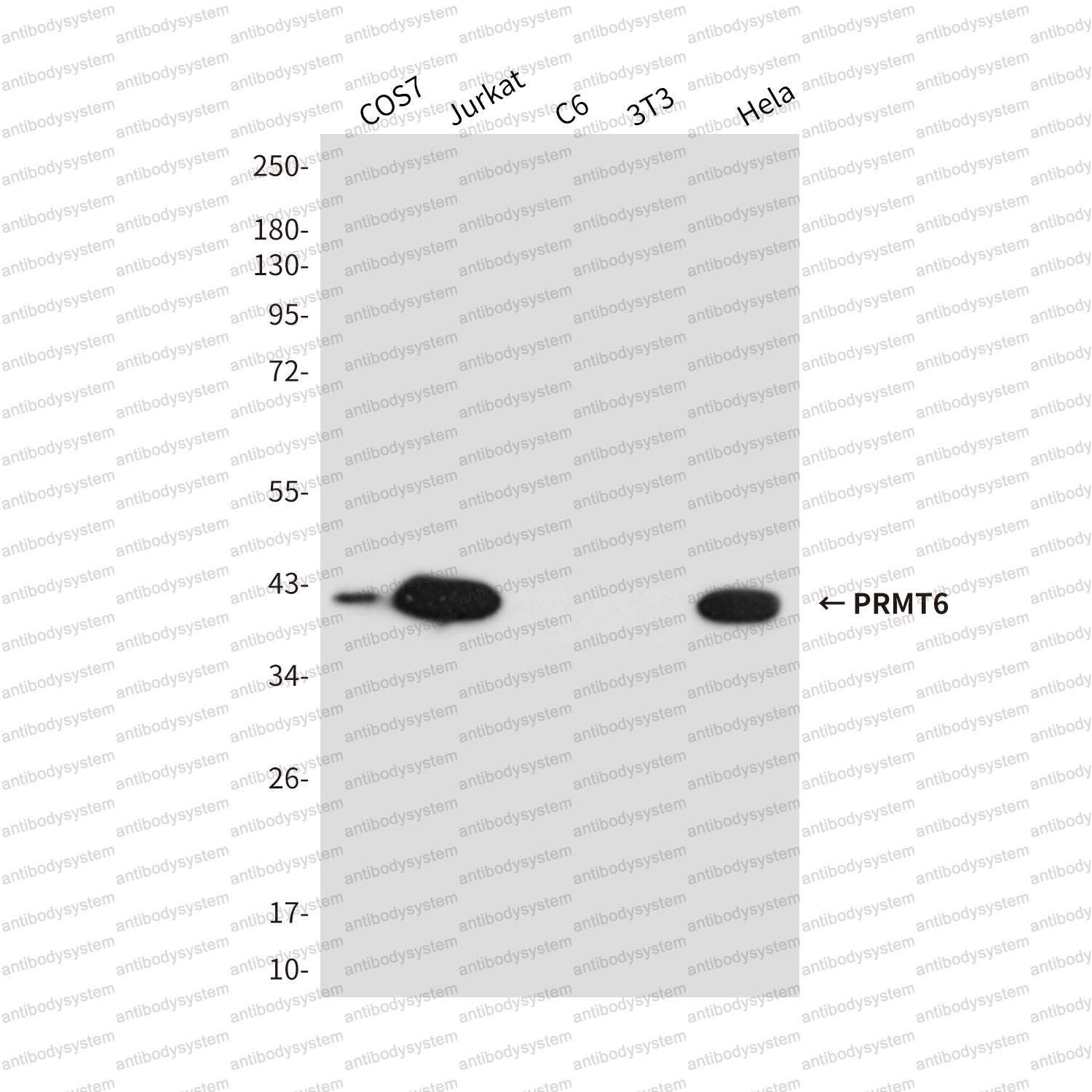 Anti-PRMT6 Antibody (R3Z06)