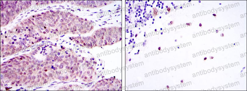 Anti-MSI2 Antibody (R3Z07)