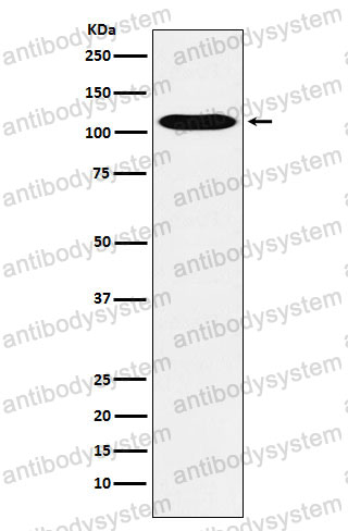 Anti-GPCR/LGR6 Antibody (R2M37)
