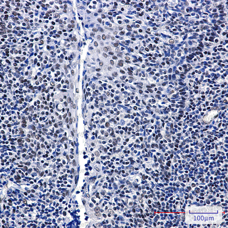 Anti-GTPBP4 Antibody (R2M40)